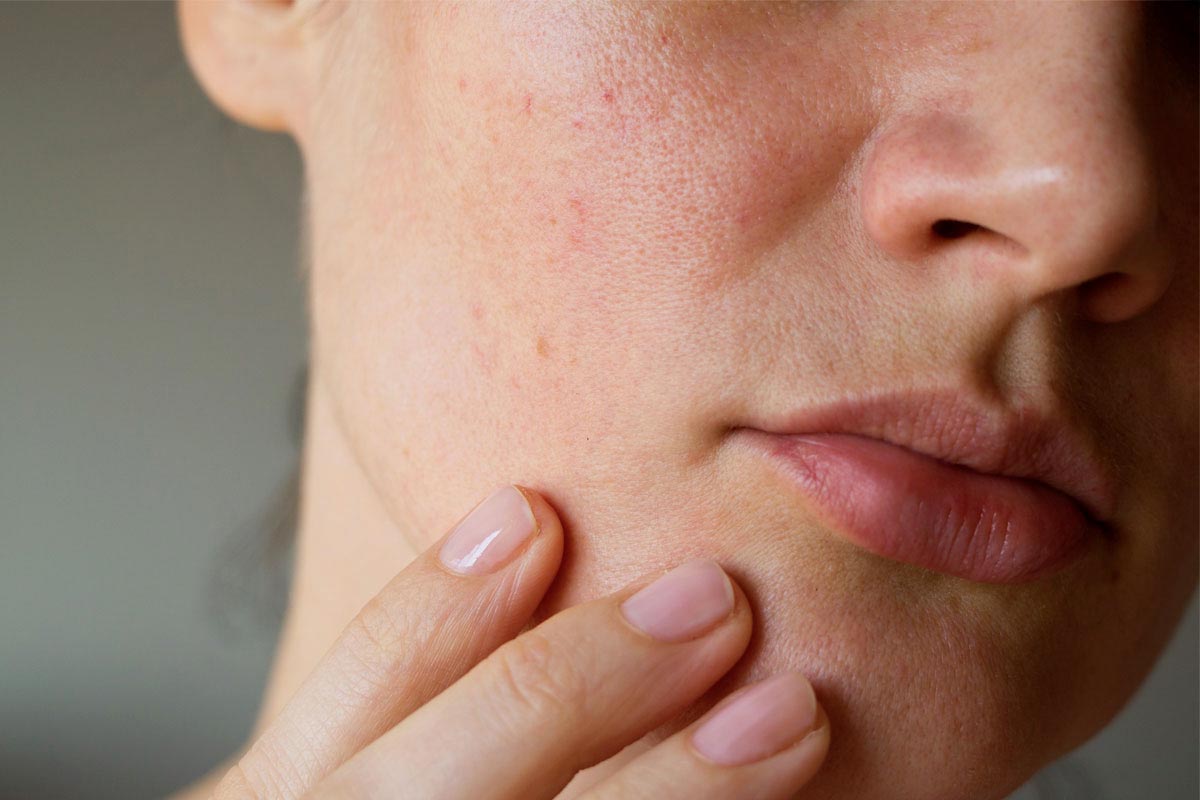 Peau et pollution - WE ARE CLEAN - CLEAN BEAUTY Image